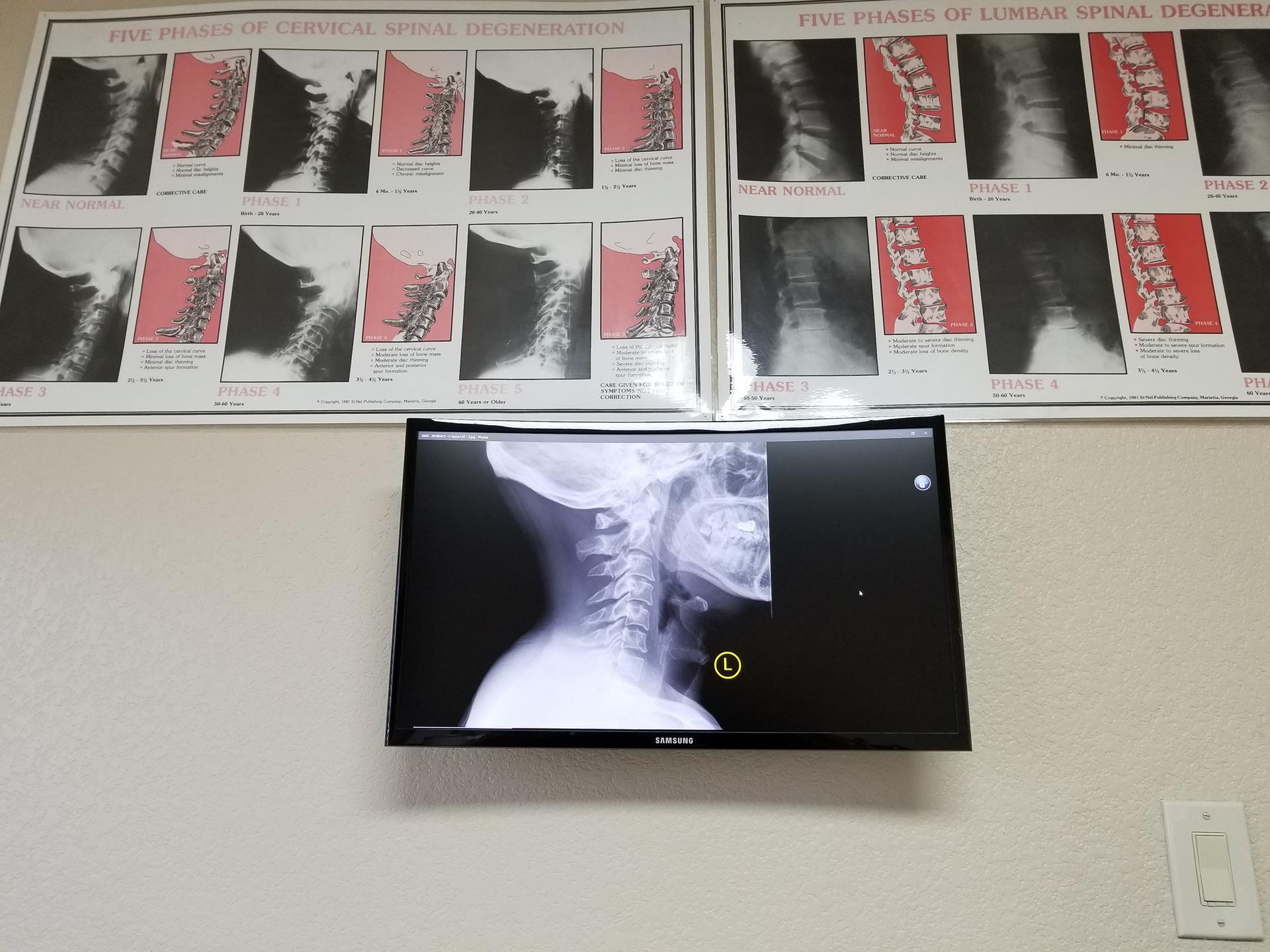 Chiropractic Specials in North Las Vegas, NV Best Care Chiropractic